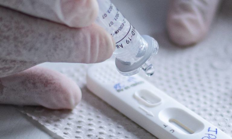 ANS decide que planos de saúde devem cobrir testes rápidos de COVID-19