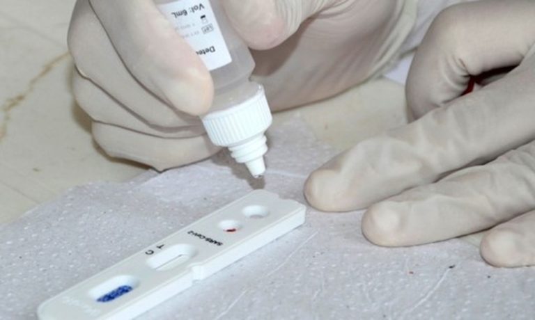 Conheça os detalhes da cobertura de teste rápido para Covid-19